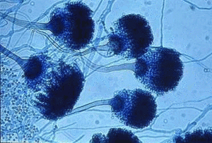 aspergillus_fumigatus_mo_gr