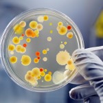 Bacteria-in-a-petri-dish-compressed